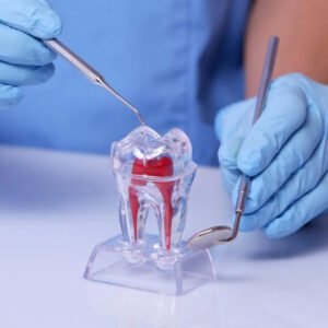 Imersão em Endodontia em Molares Decíduos